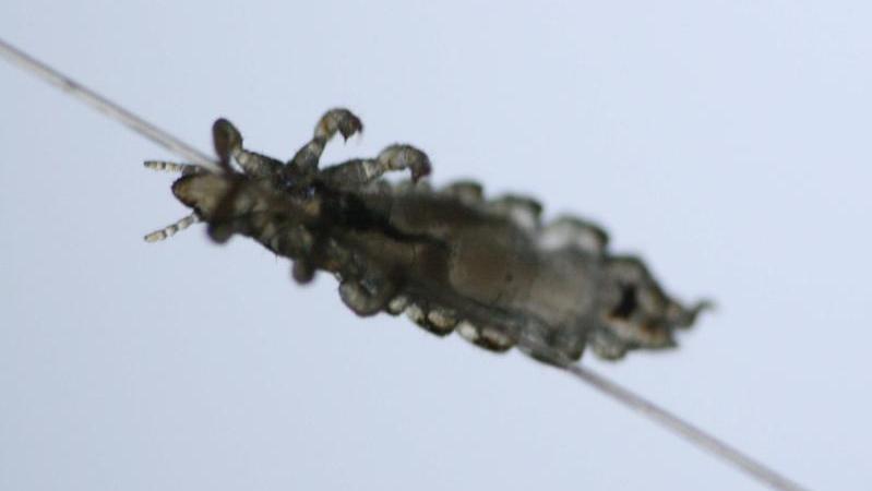 Kopflaus