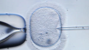 Darf man vor der Einpflanzung von künstlich befruchteten Eizellen auf Erbkrankheiten testen?