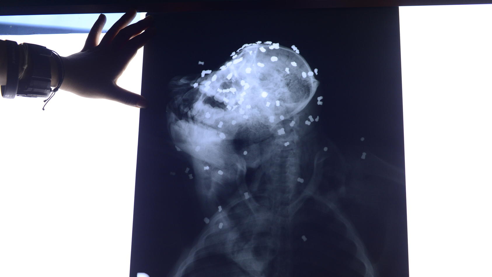 Erschreckendes Röntgenbild: Auf diesen Orang-Utan wurde 130 Mal mit einem Luftgewehr geschossen.