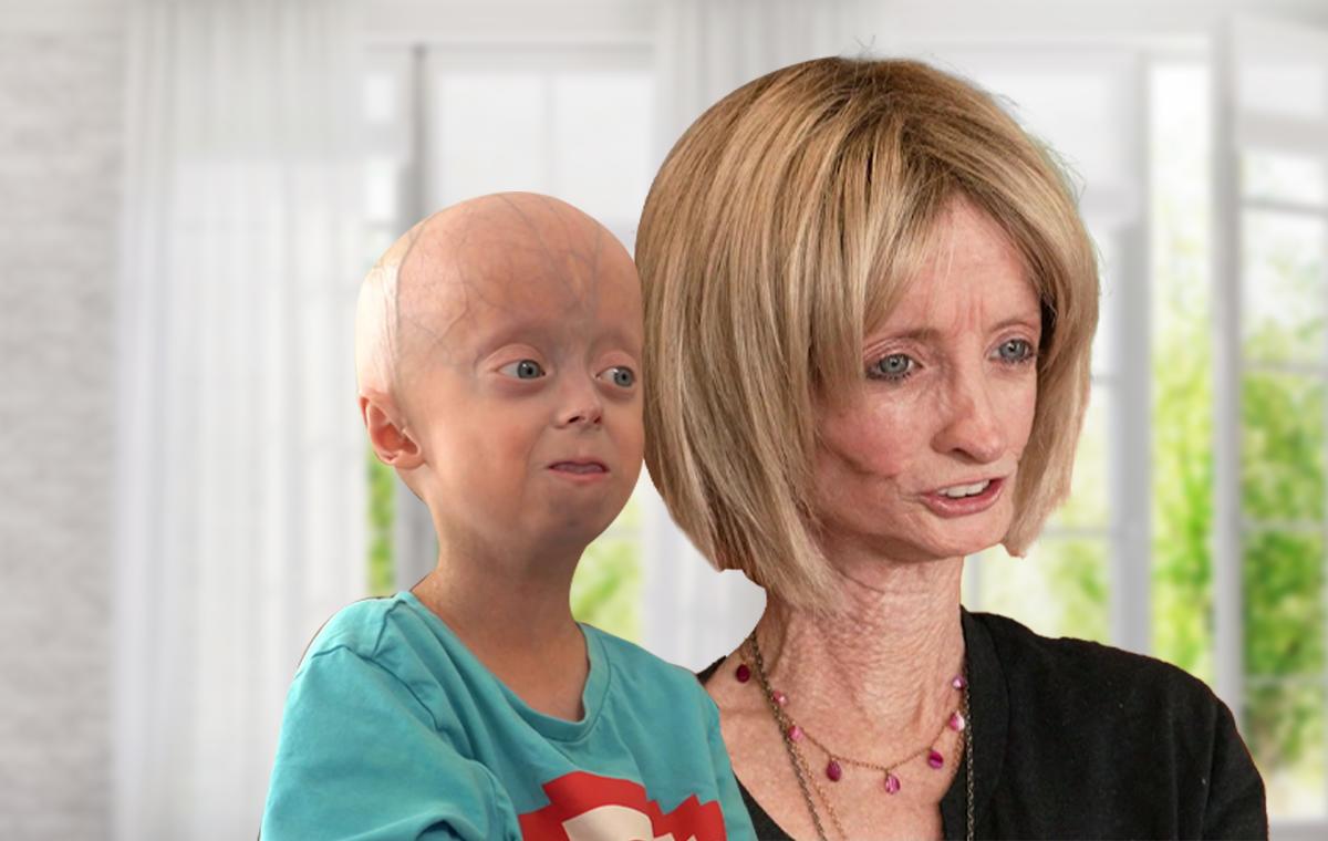 auergewohnliches-treffen-luke-7-und-die-alteste-progerie-frau