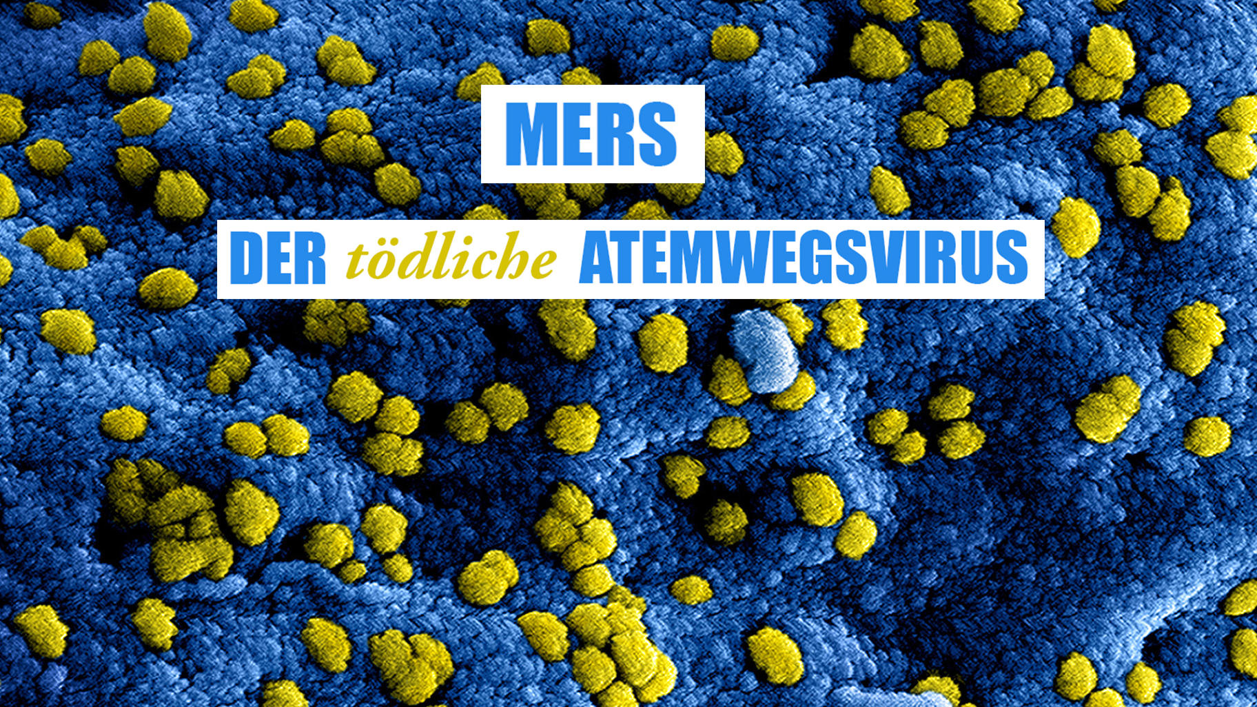 MERS - der tödliche Atemwegsvirus Ursprung, Überträger, Symptome, Prävention