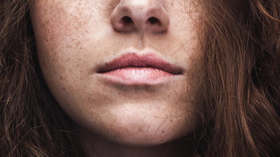 6 Tipps gegen spröde Lippen Seidigweich