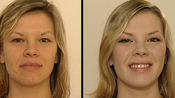 Akne ganz unkompliziert wegschminken Anti-Pickel Make-up vom Profi 
