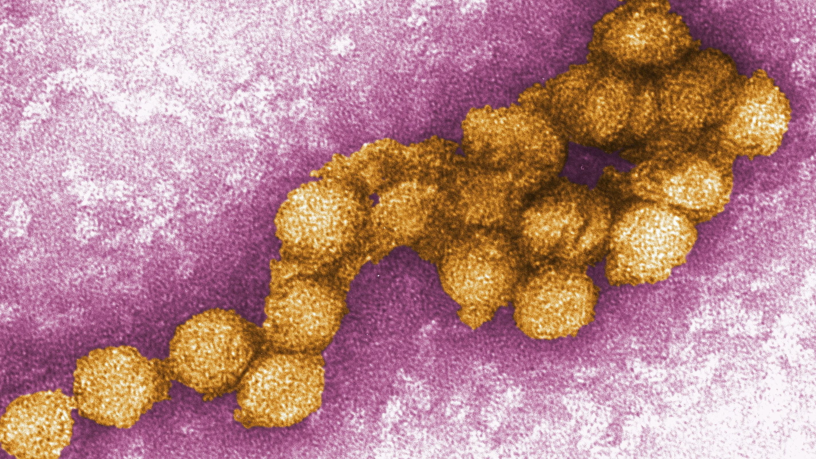 Gefährliches West-Nil-Virus erreicht Deutschland Mildes Klima begünstigt Ausbreitung