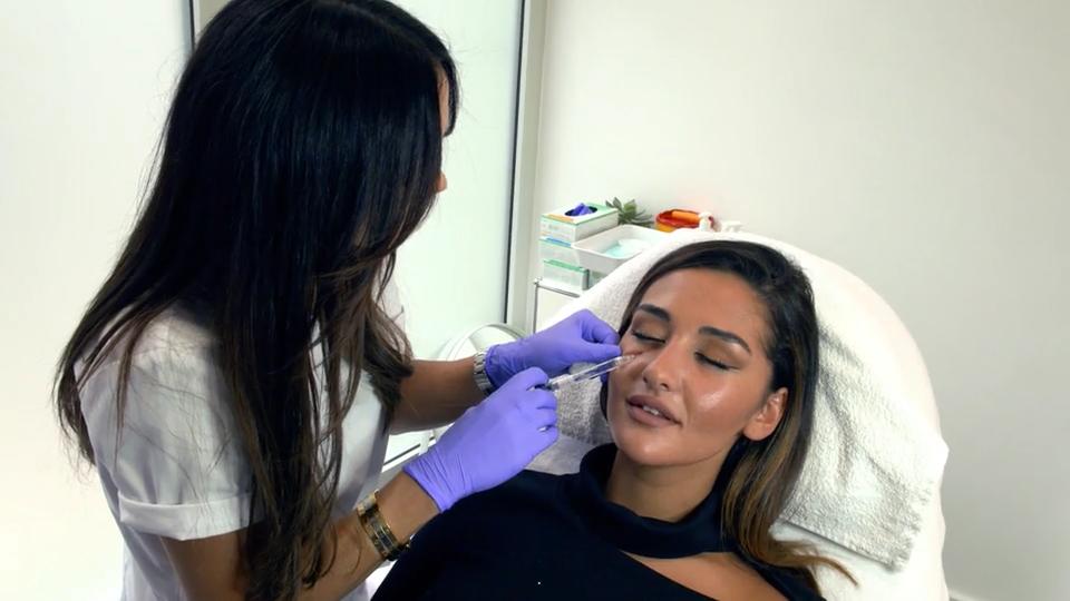 Unterspritzung von Augenrändern Wird häufig gemacht