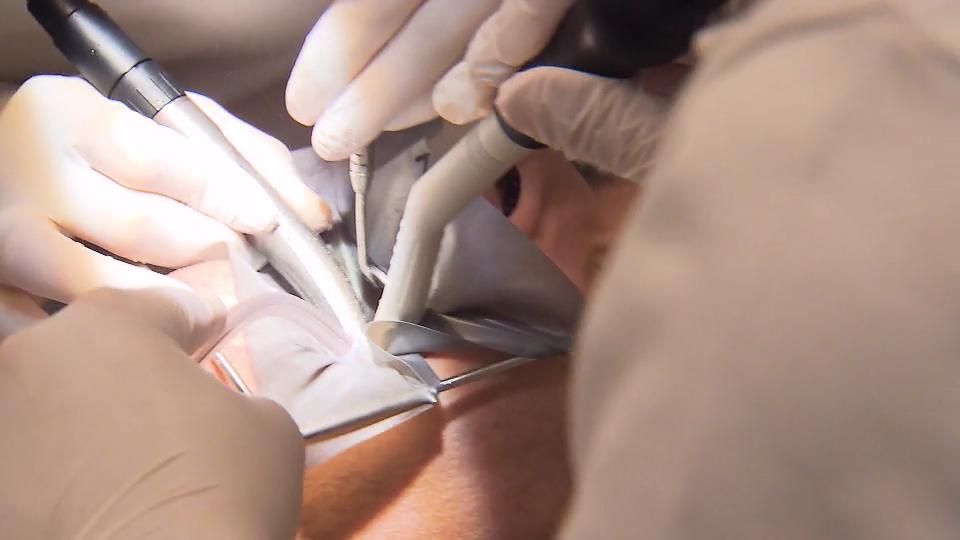 Patient darf Amalgam nicht verschlucken Zahnärztin muss vorsichtig arbeiten