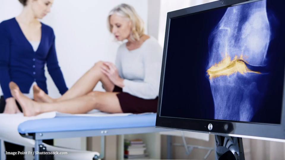 Was ist eine Arthrose? Der Knorpel  reibt sich ab