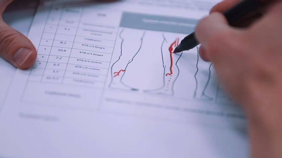 Thrombose - was ist das eigentlich? Das sind die Gefahren