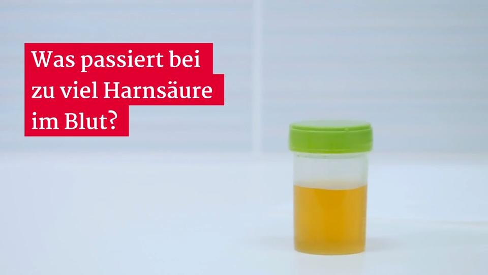 Was passiert bei zu viel Harnsäure im Blut? Gesundheitslexikon