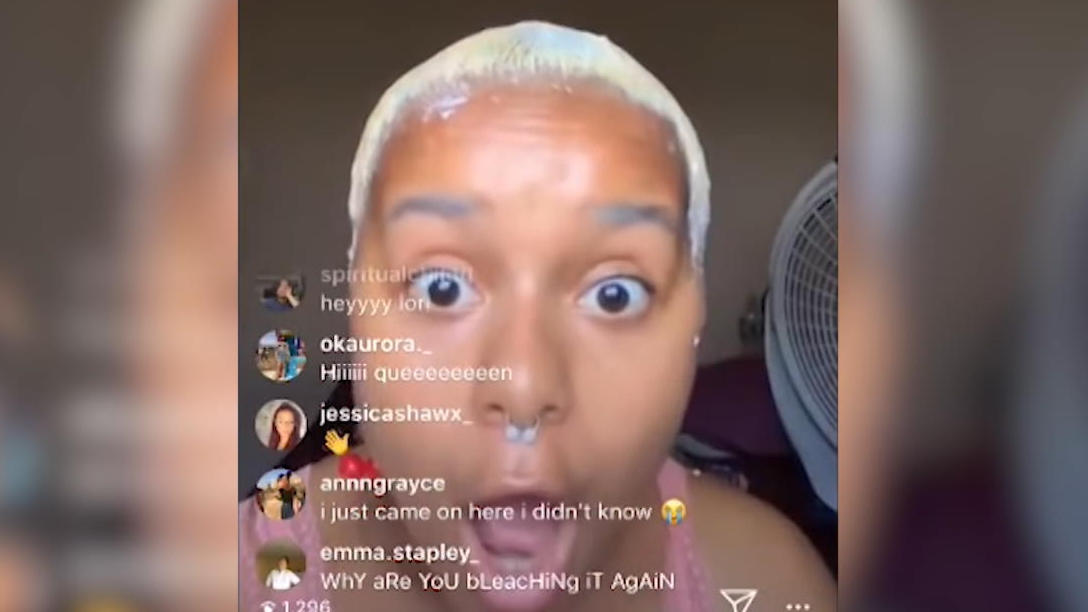 Instagramerin fallen im Livestream die Haare aus Lori Faith wollte ihre Haare glätten