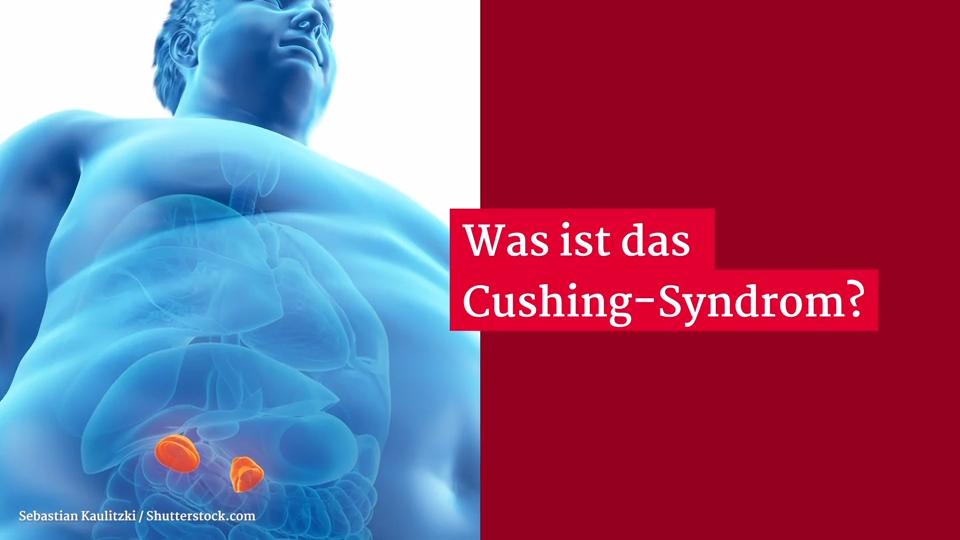 Gesundheitslexikon: Cushing-Syndrom