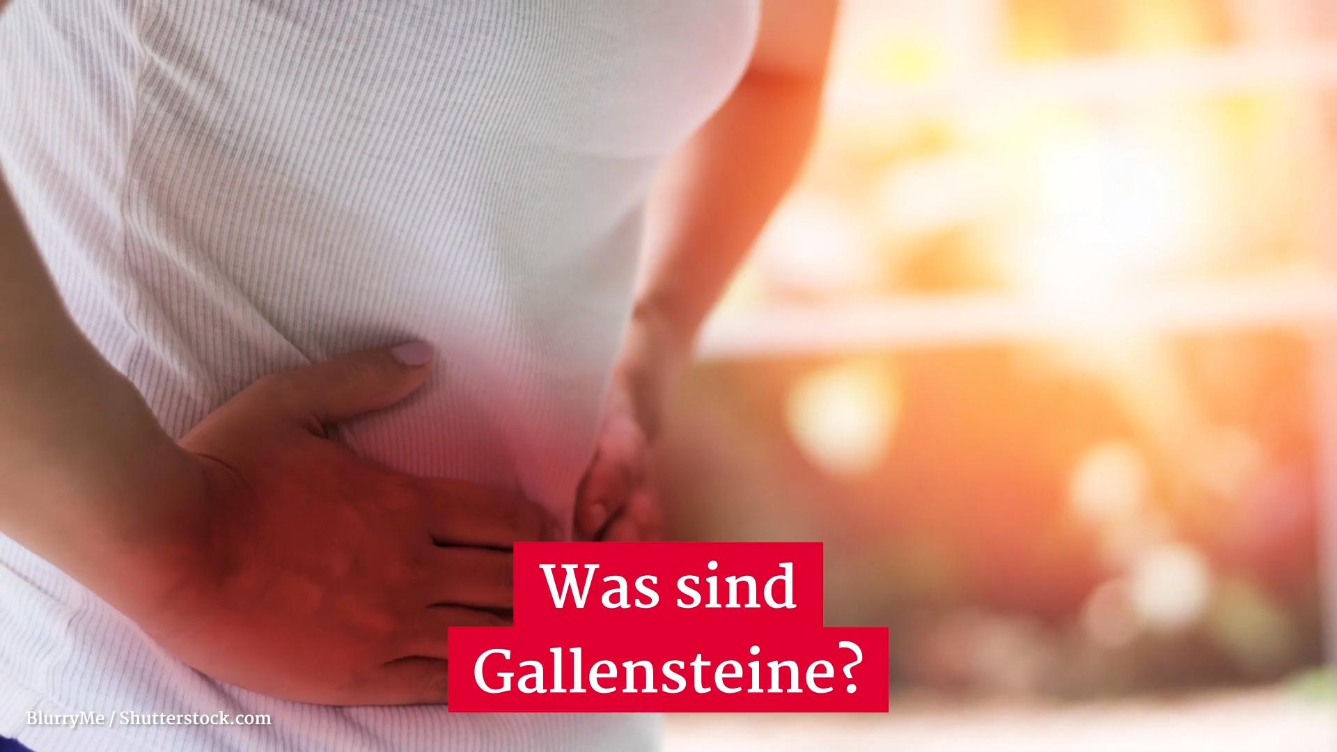 What are gallstones?  Health Dictionary