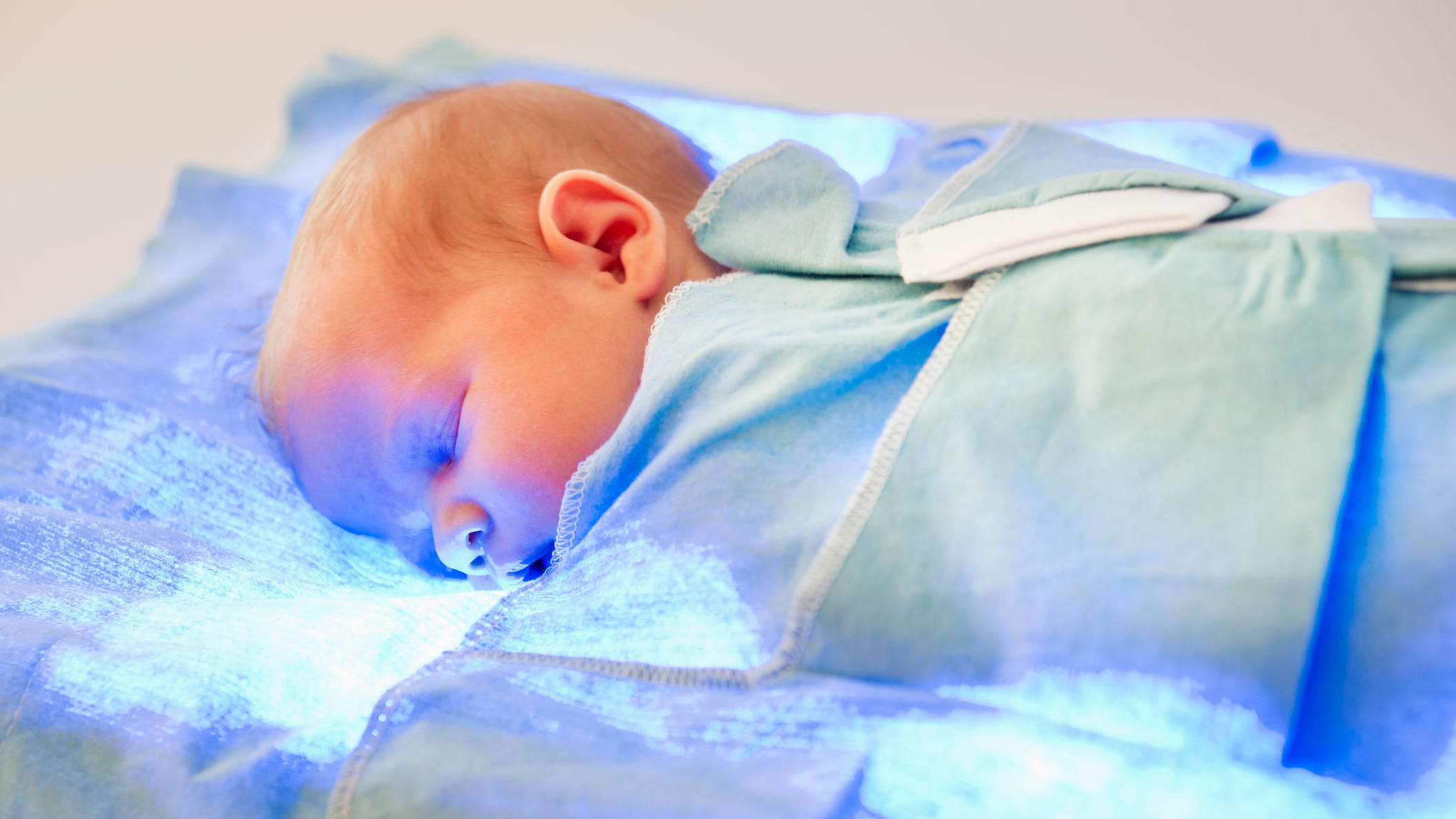 Gelbsucht und Kernikterus beim Neugeborenen Gesundheitslexikon