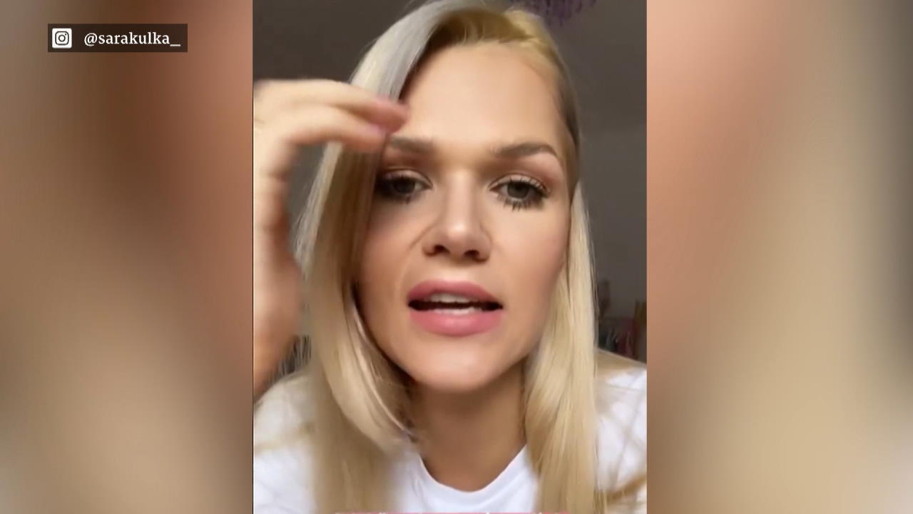 Sie steht zu ihren Schönheitseingriffen Model Sara Kulka
