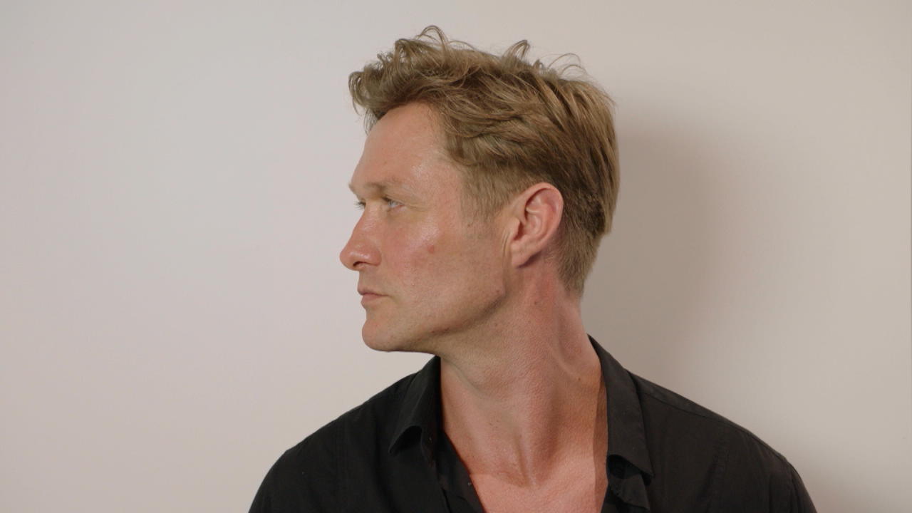 Nico Schwanz unterzieht sich Mascu-Look-Therapie Für ein männlicheres Kinn beim Beauty-Doc