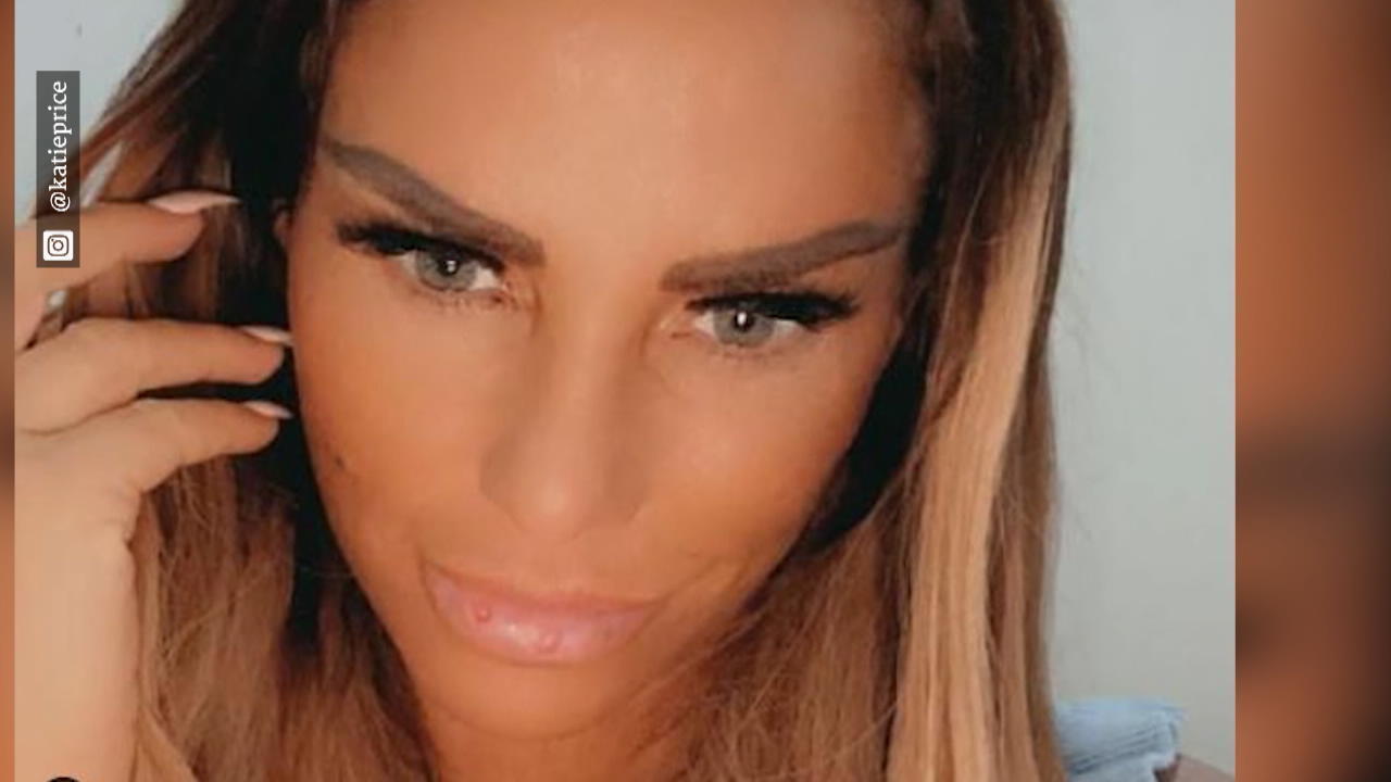 Katie Price hat Bläschen an den Lippen Hepatitis oder Sonnenblasen?