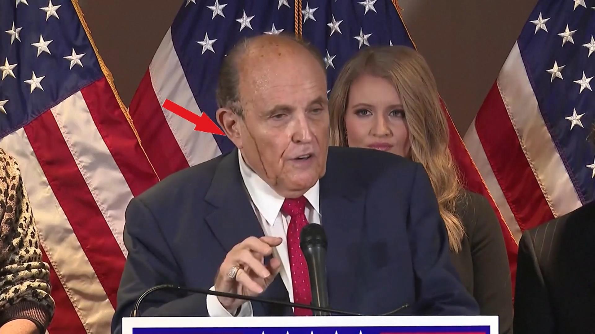 Rudy Giuliani & Co.: Peinliche Make-up-Pannen der Promis Fließende Haarfarbe und Selbstbräuner-Flecken