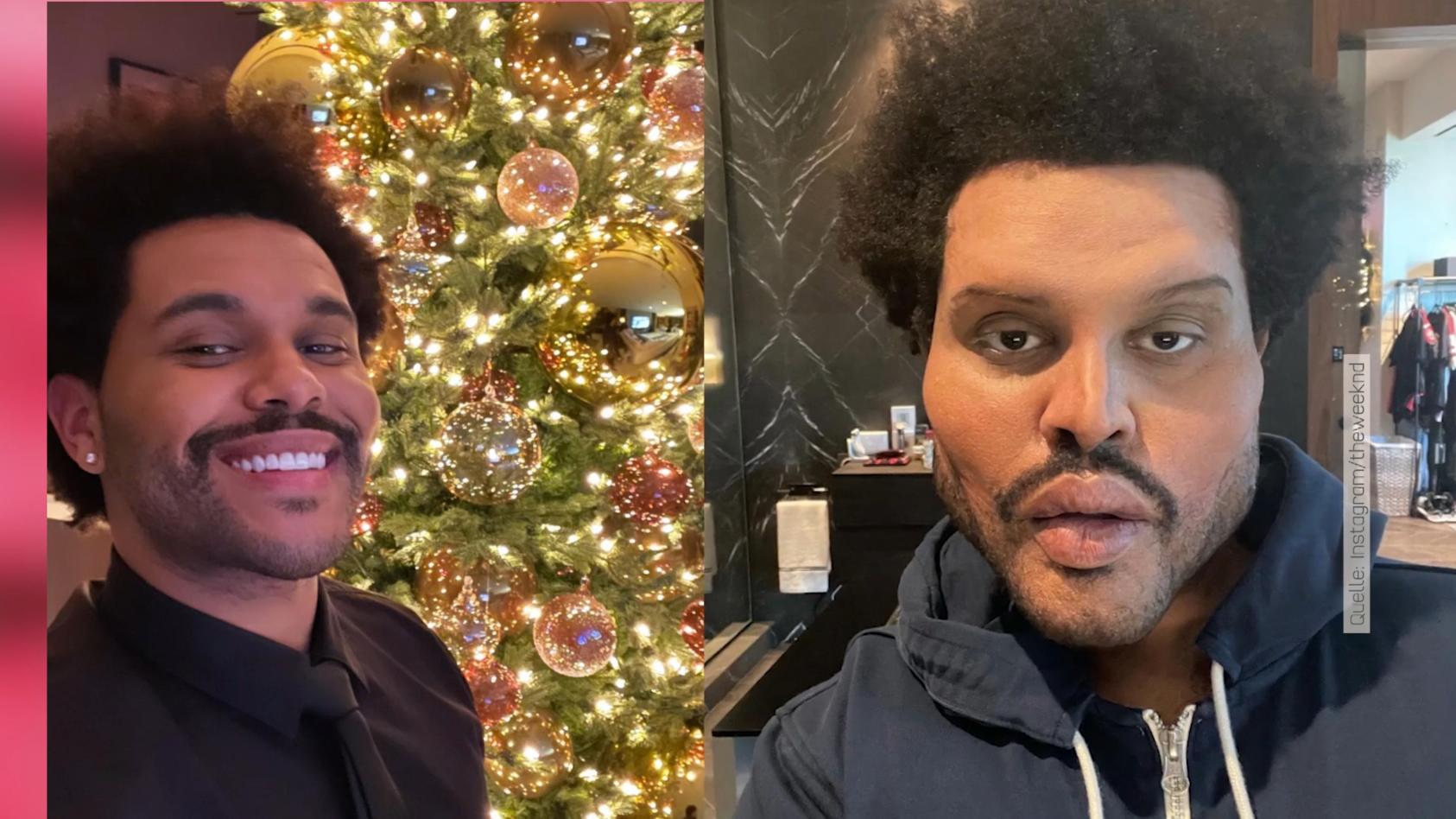 Sänger The Weeknd sieht plötzlich ganz verändert aus! Was ist denn mit dem passiert?