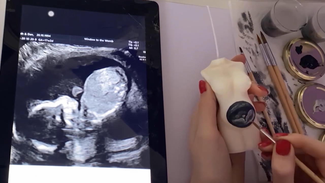 Frau zeichnet Ultraschallbilder auf Kerzen Sie kann sich vor Anfragen nicht mehr retten