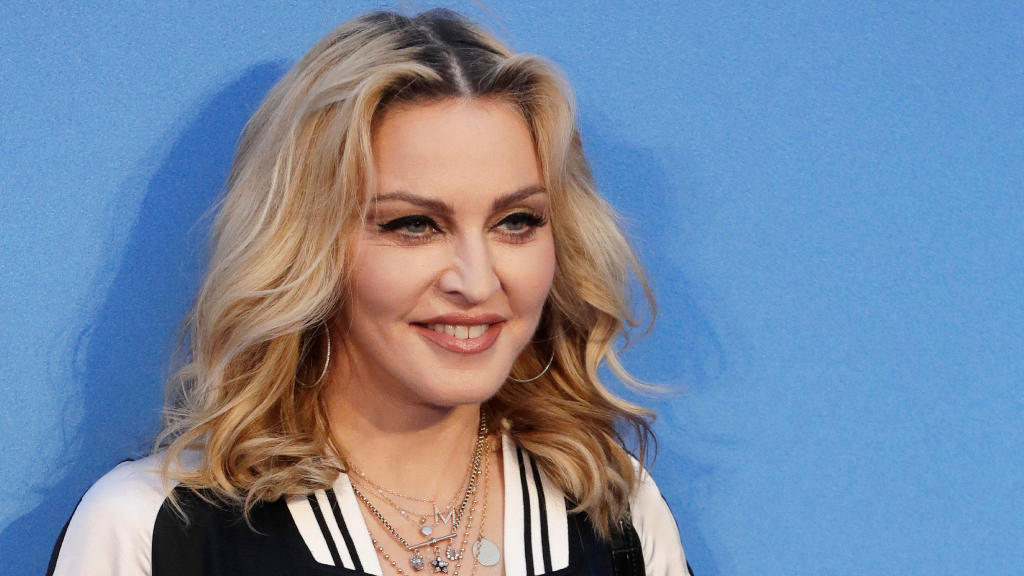 Huch, nur ein Filter? Wie sieht Madonna denn neuerdings aus? Grusel-Look auf Instagram