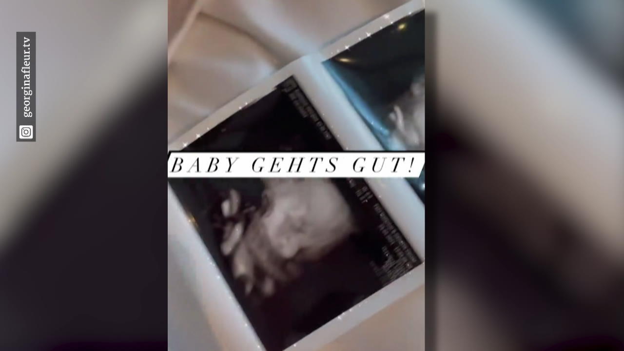 Georgina Fleur postet 3D-Ultraschall "Baby geht's gut"
