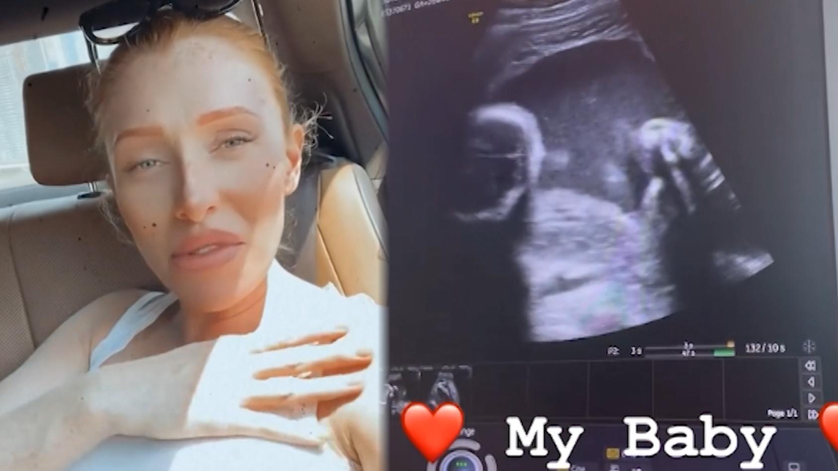 Georgina Fleur beim Ultraschall in Dubai Bewegtbild vom Baby