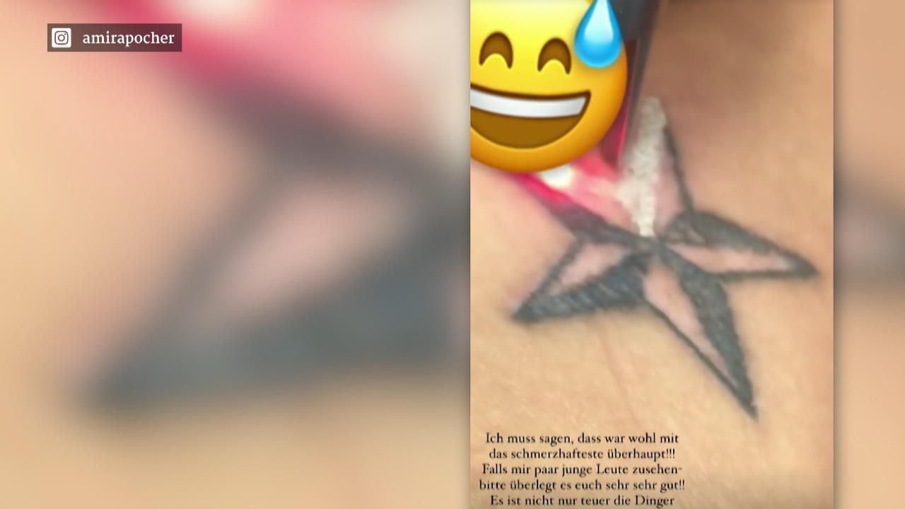 Amira Pocher lässt ihre Tattoos entfernen Adé Jugendsünden