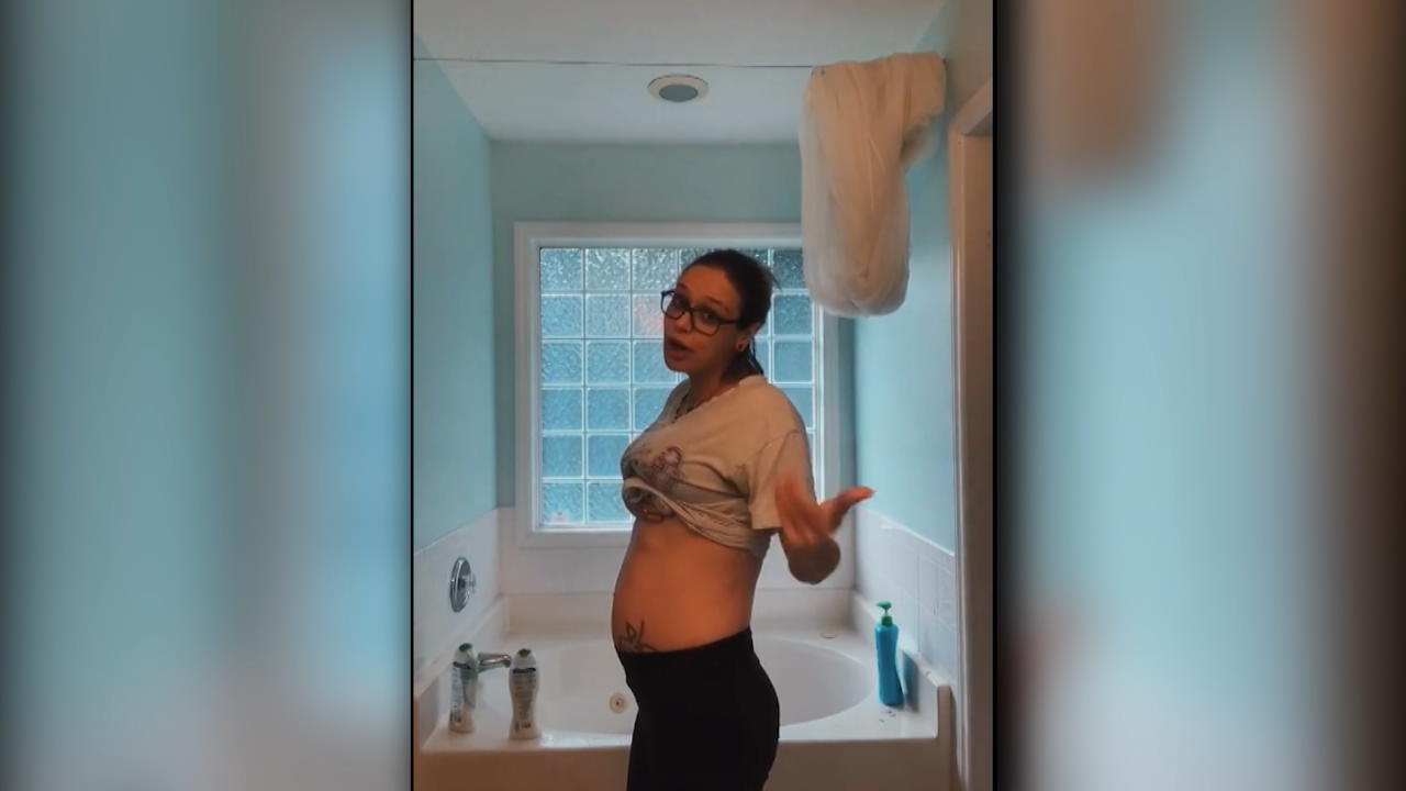 Zwillingsüberraschung trotz Mini-Babykugel Kleiner Schwangerschaftsbauch geht viral