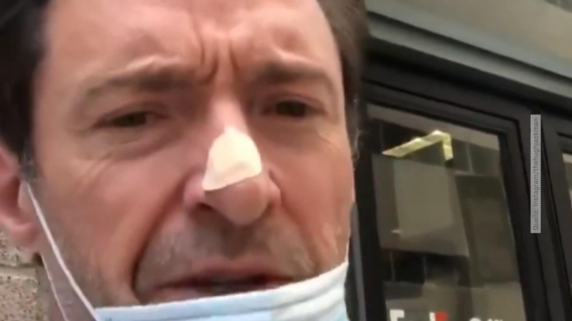 Hugh Jackman: Schon wieder Hautkrebs? "Wolverine"-Star musste wieder unters Messer