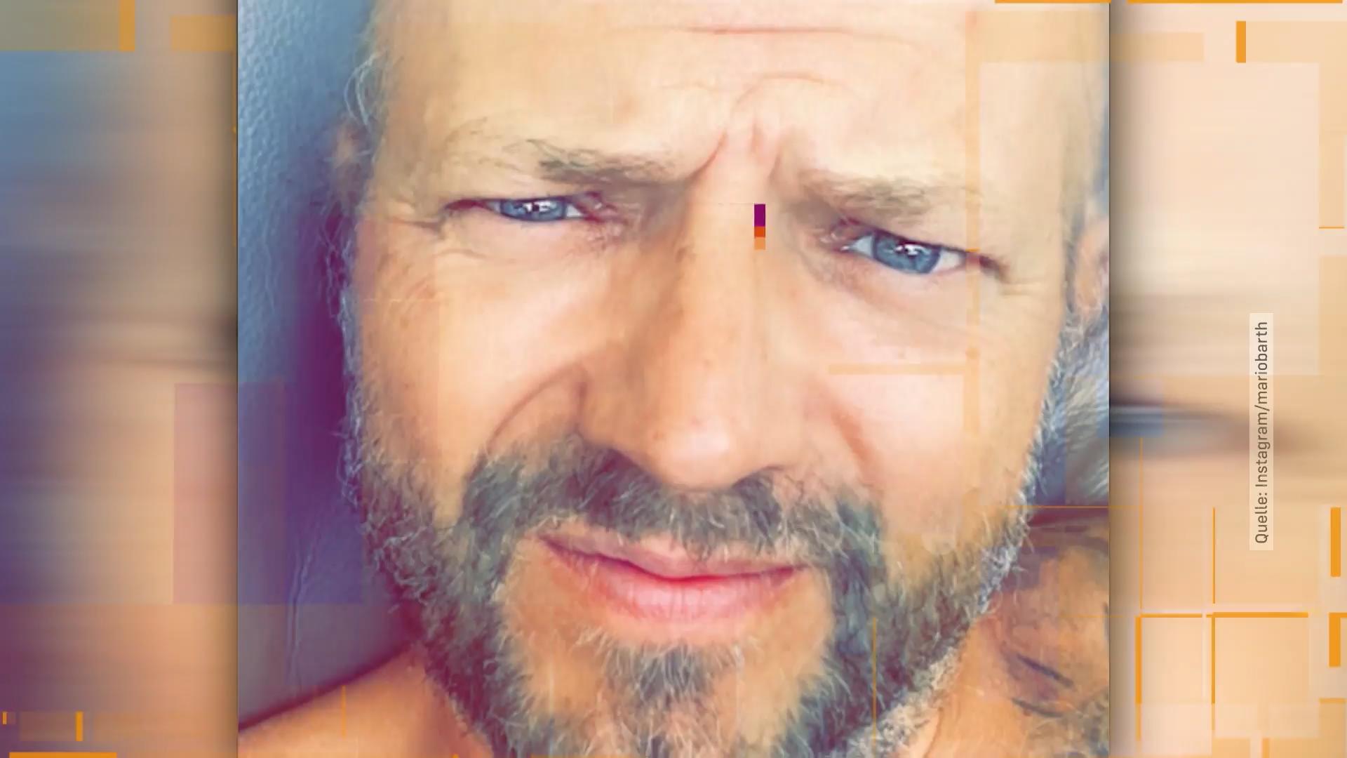 Comedian Mario Barth trägt jetzt Glatze! Die Matte ist ab