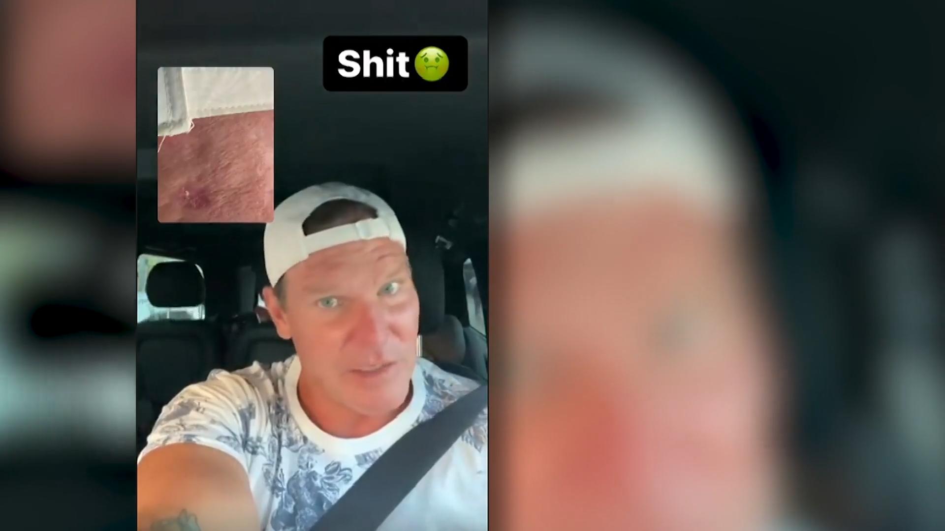Sommerhaus-Star Steff Jerkel hat Hautkrebs Schock-Diagnose