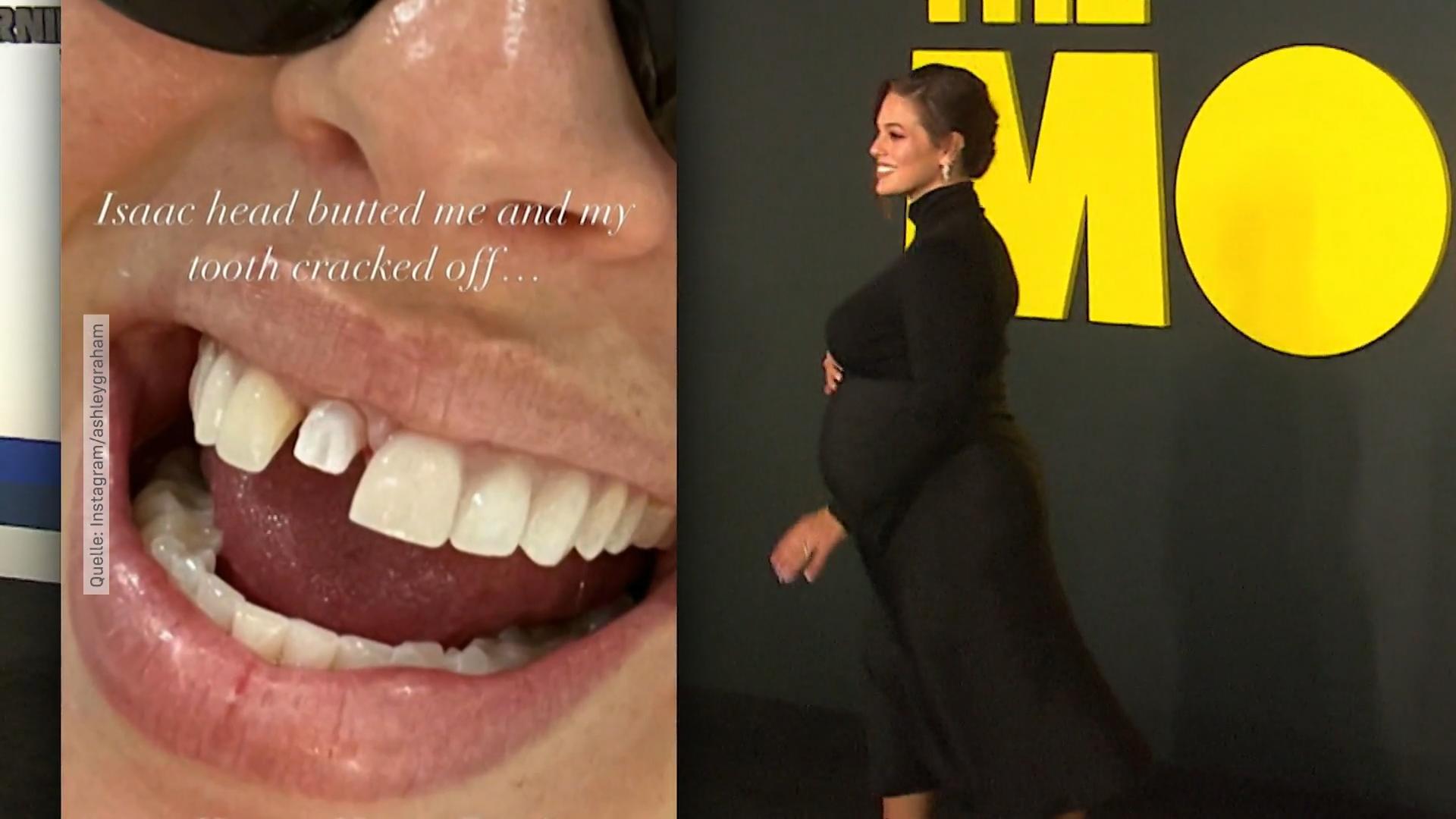 Ashley Grahams Zahn ist abgebrochen Nach Kopfnuss von ihrem Sohn