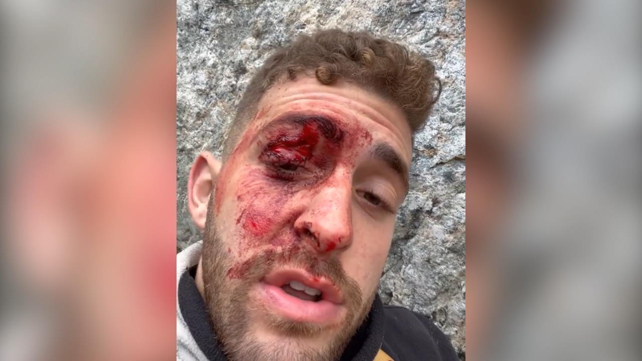 Tourist macht Abschiedsvideo für Mutter – und wird gerettet Er fiel beim Wandern 10 Meter tief