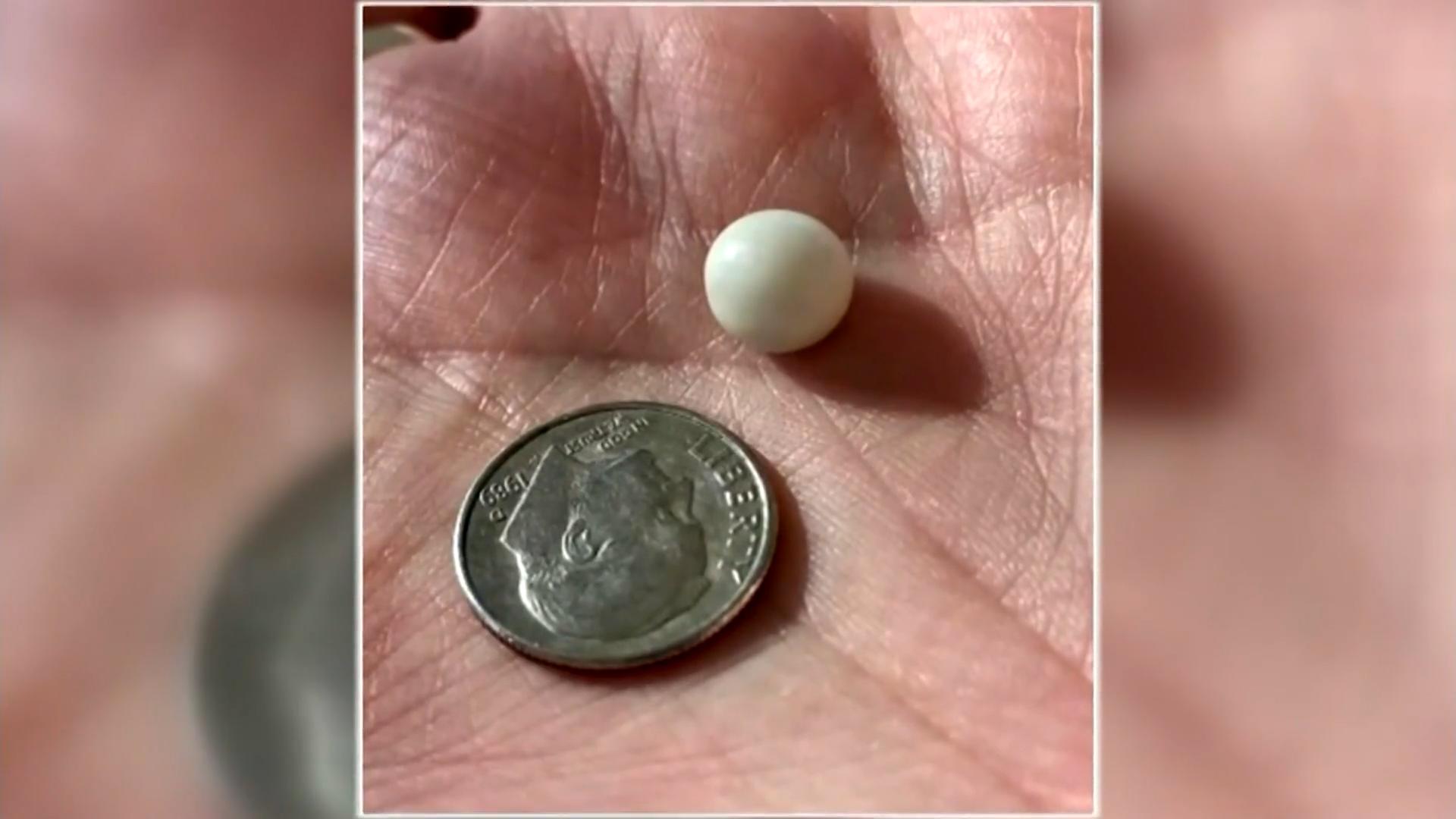 Ehemann bestellt Muscheln - und findet seltene Perle Wert von Tausenden Dollar