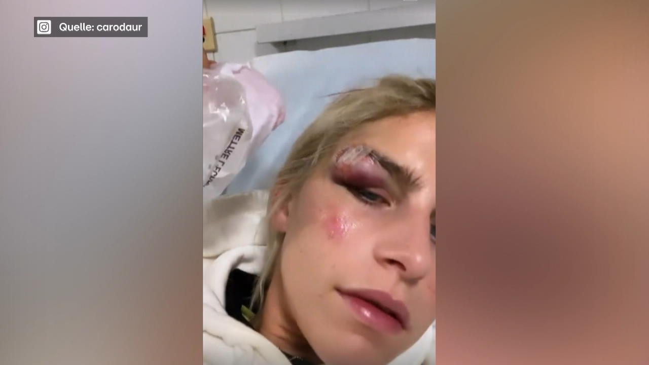 Caro Daur hatte blutigen Jogging-Unfall Sie musste genäht werden