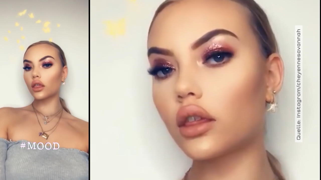 Cheyenne Ochsenknecht gesteht Beauty-Eingriff Aufgespritze Lippen