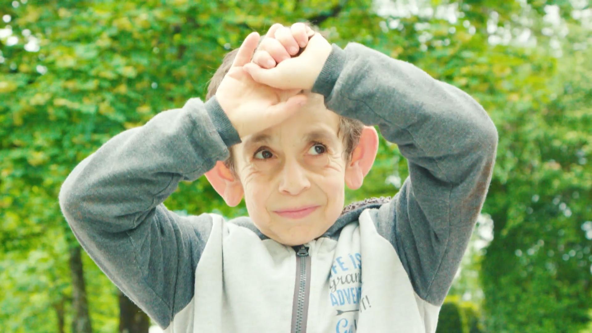 Mohameds (7) Eltern dachten, er sei todkrank Fehldiagnose Progerie