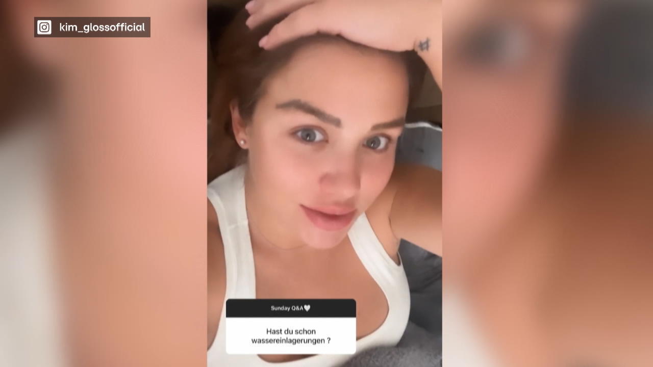 Kim Gloss hat extreme Wassereinlagerungen Anstrengende Schwangerschaft