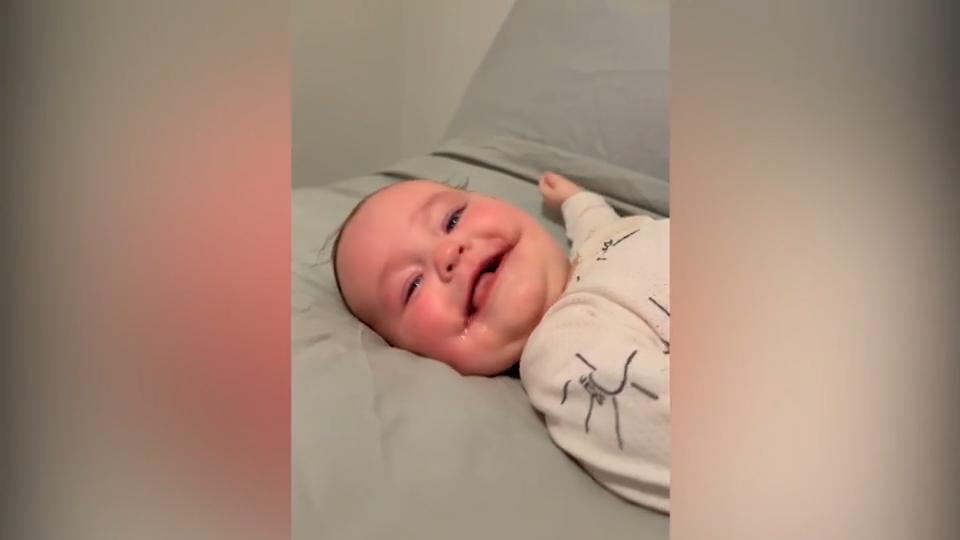 Baby Ayla trägt ein "Dauerlächeln" im Gesicht Seltene Fehlbildung
