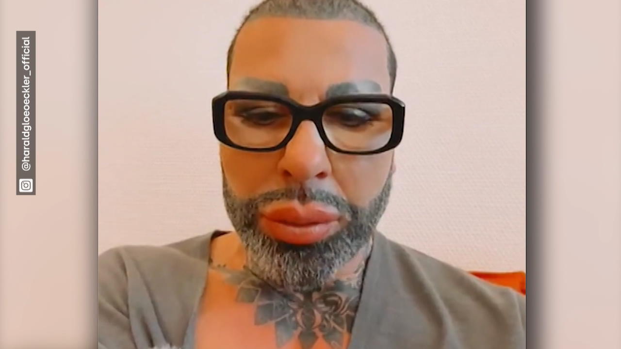 Harald Glööckler weint um seinen Hund Billy King muss operiert werden