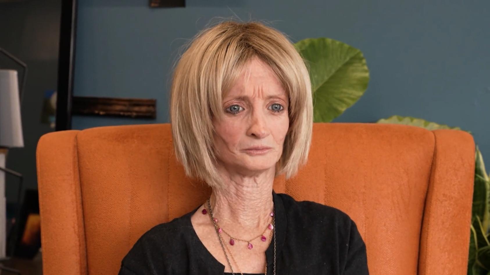 Tiffany Wedekind ist umgerechnet 344 Jahre alt 45-Jährige hat Progerie
