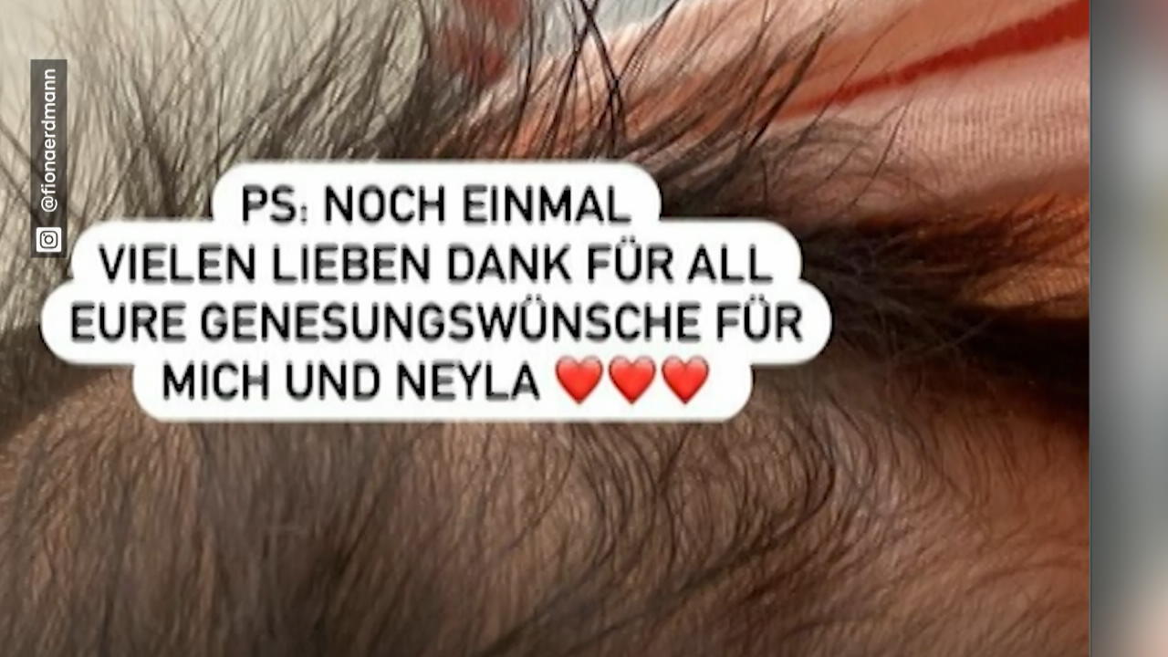 OP für Fiona Erdmanns Baby? Neyla hat einen Leistenbruch