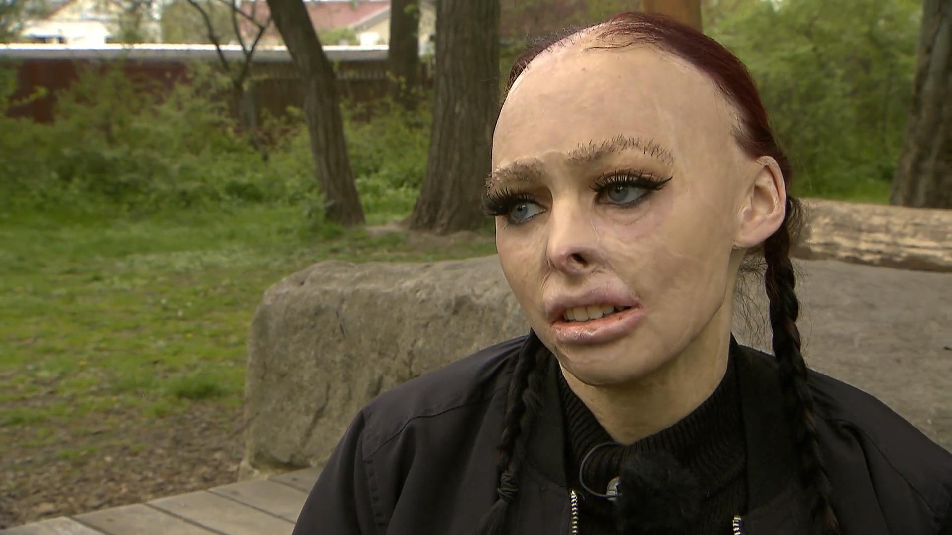 OP zaubert Brandopfer Torina (22) ein Lächeln ins Gesicht Nach fürchterlichem Hausbrand