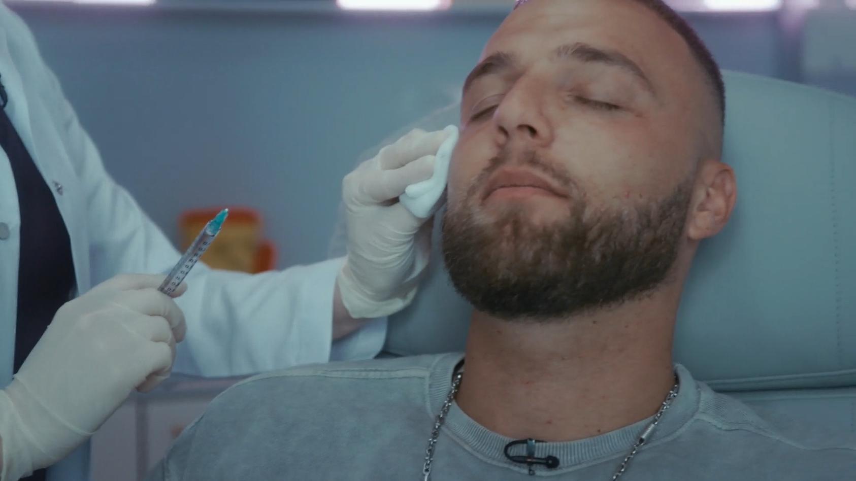 Filip Pavlovic unterzieht sich Beauty-Behandlungen Für glatte Haut im Gesicht
