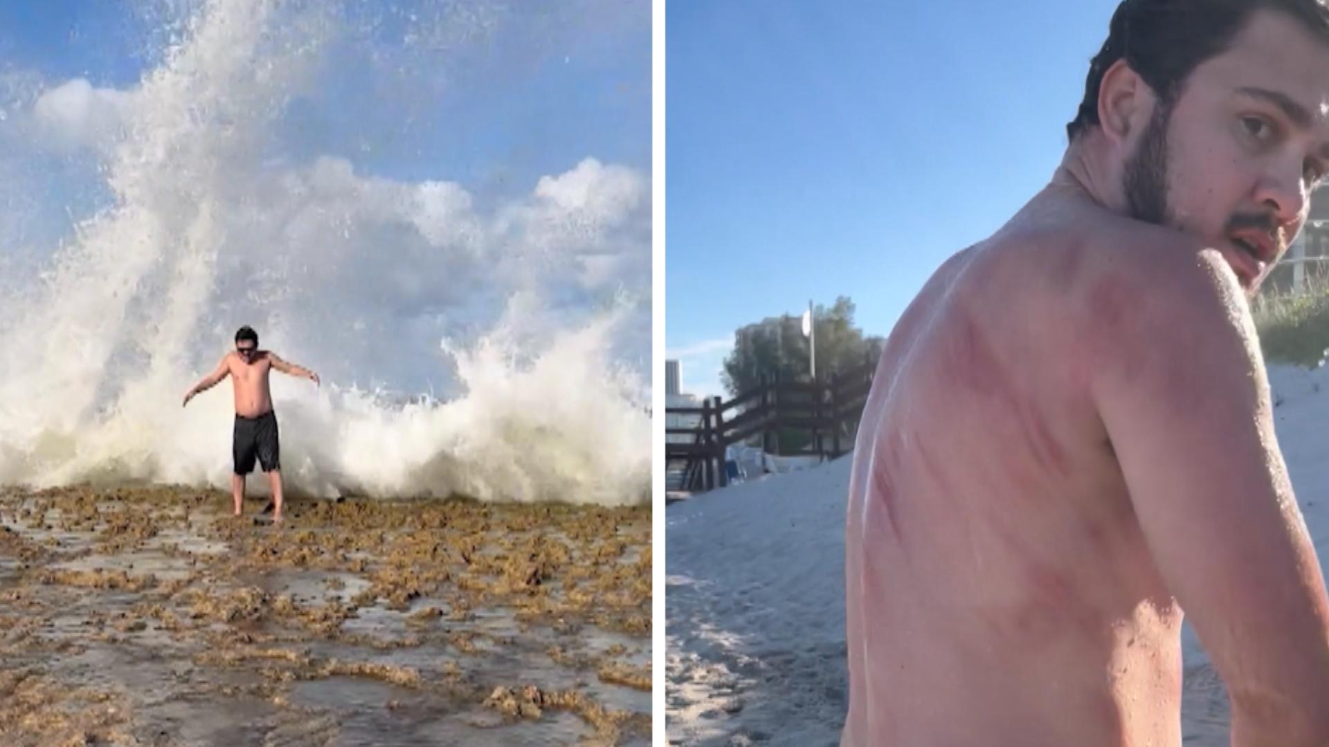 Posing endet blutig: Welle schleudert Mann auf Steine Schmerzhafte Urlaubserinnerung