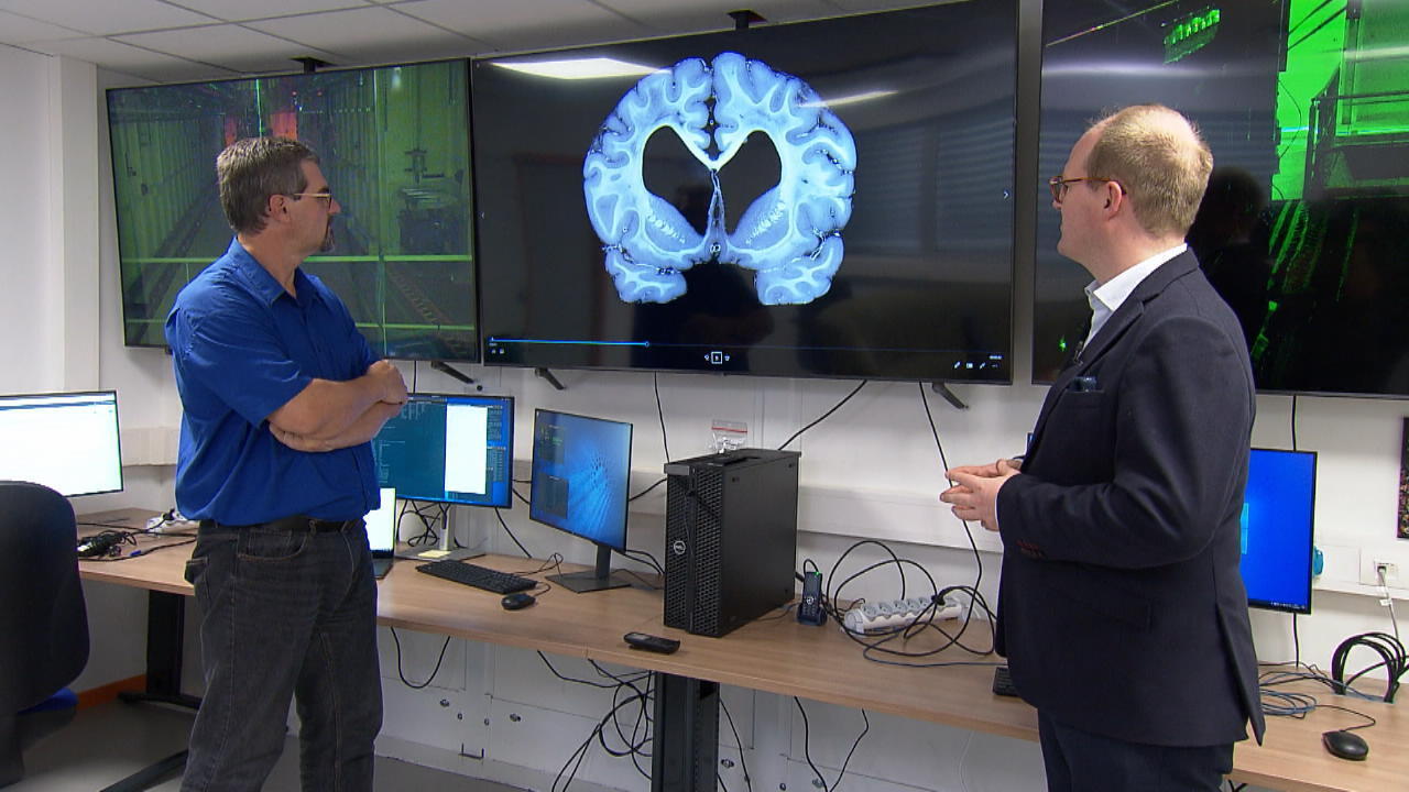 Röntgengerät macht tausendfach bessere Fotos als ein CT-Scan Medizin-Revolution aus Frankreich