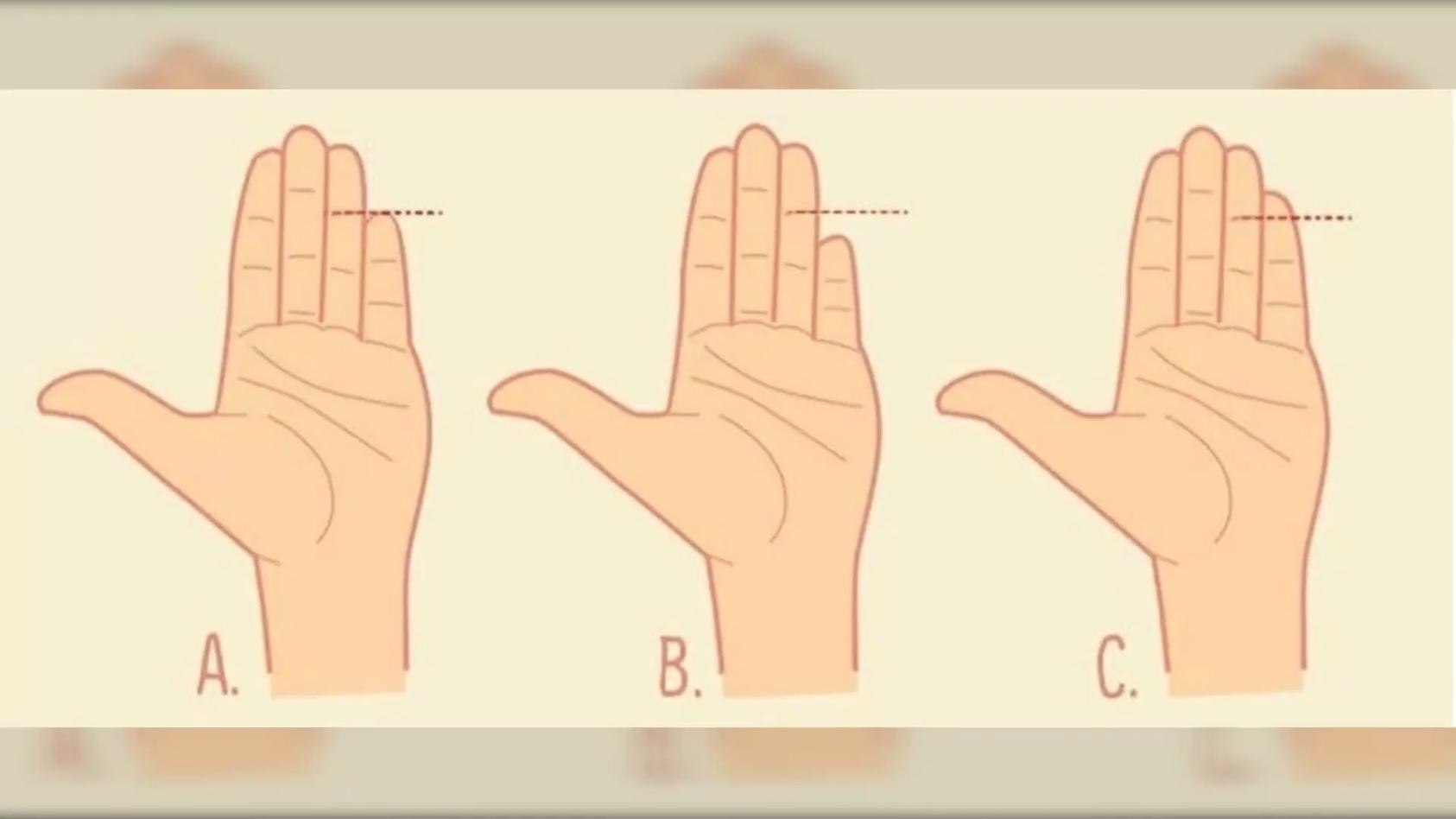 Die Länge des kleinen Fingers verrät unsere Persönlichkeit Kleiner Fingerschwur