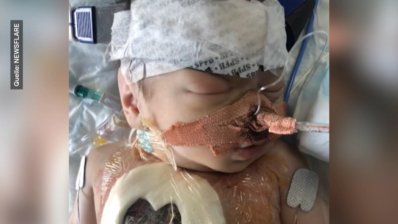 Baby Dorothea überlebt trotz schweren Herzfehlers Eltern verweigerten Abtreibung