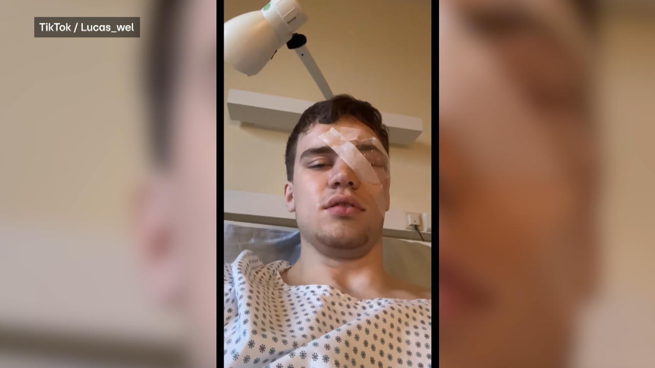 Kampf um das Augenlicht Nach Böllerunfall