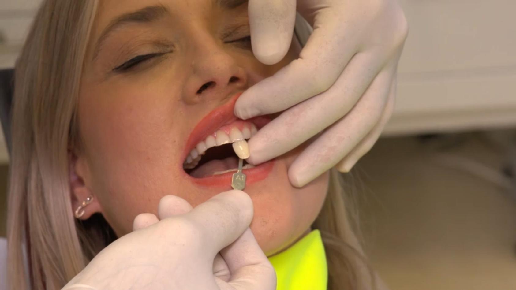 Weißere Zähne dank lila Zahnpasta? Wir machen den Test